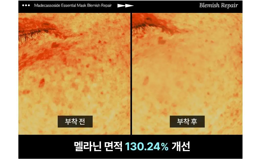 [15년 연속 1위] 메디힐 에센셜 마스크팩 10매/10+1매 기획 7종 골라담기 상세페이지 11